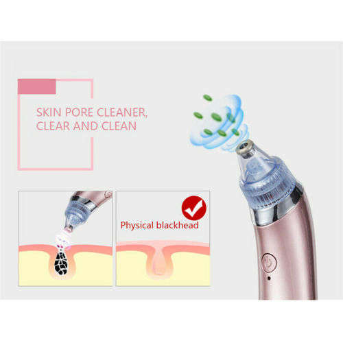 Electric Facial Cleaner Blackhead Vacum Meter Nose Pore Acne Suction Remover!