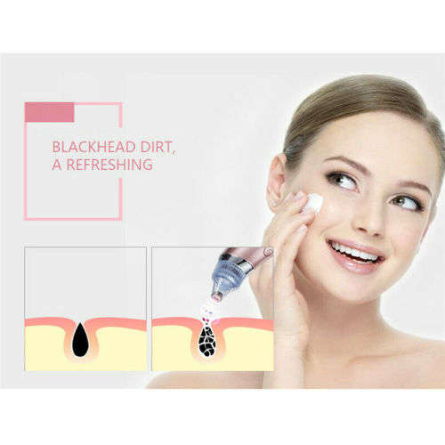 Electric Facial Cleaner Blackhead Vacum Meter Nose Pore Acne Suction Remover!