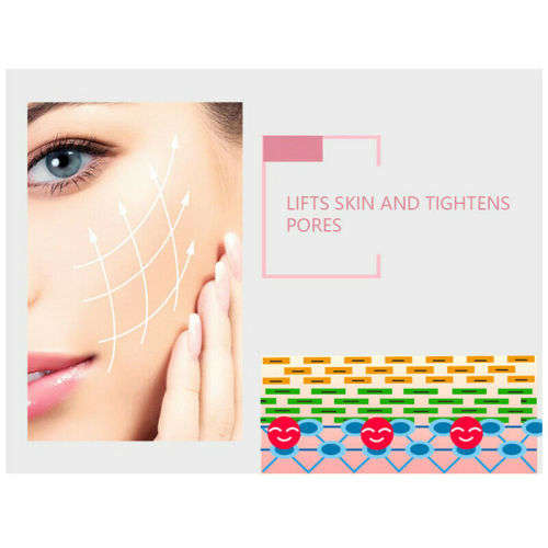 Electric Facial Cleaner Blackhead Vacum Meter Nose Pore Acne Suction Remover!