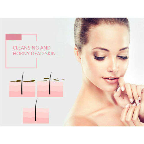 Electric Facial Cleaner Blackhead Vacum Meter Nose Pore Acne Suction Remover!