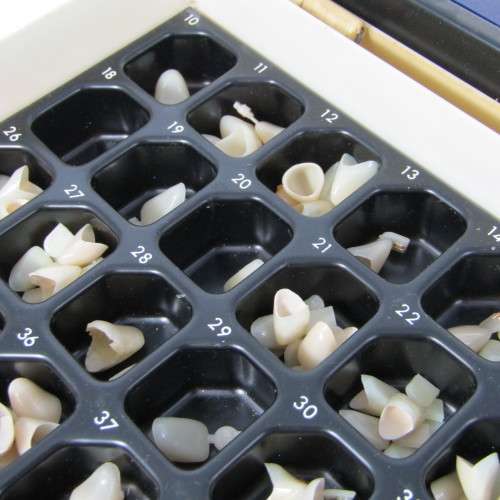 Vintage Dorecta dentist ctown teeth set in case