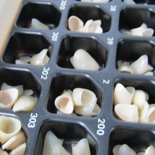 Vintage Dorecta dentist ctown teeth set in case