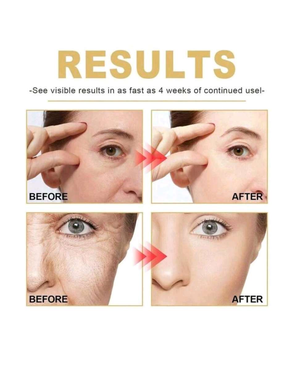 Retinol Instant Wrinkle Remove Face Serum 50ml with Derma roller