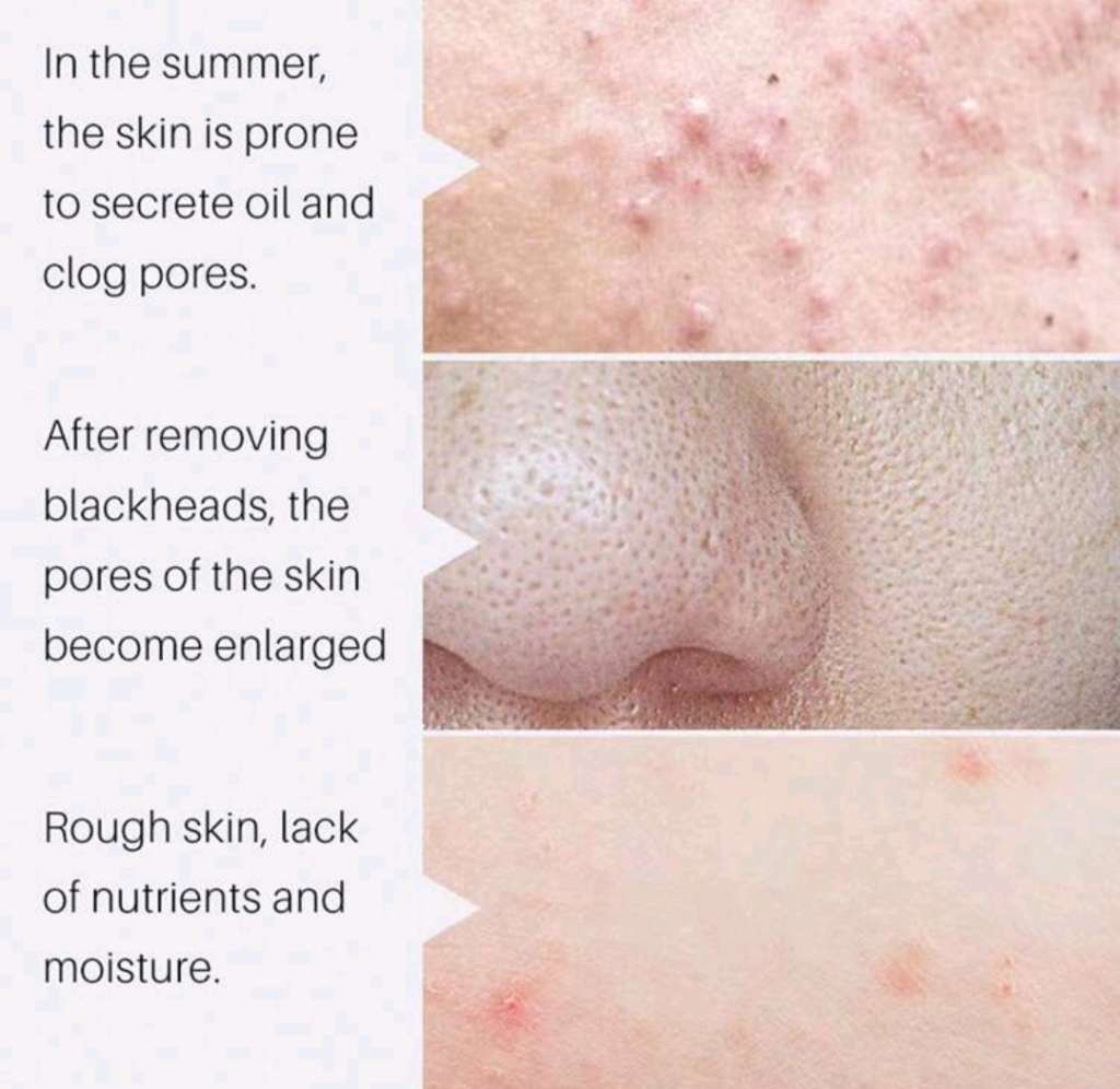 TRSTAY High Moisturizing Face Cream and Pore Shrinking Serum