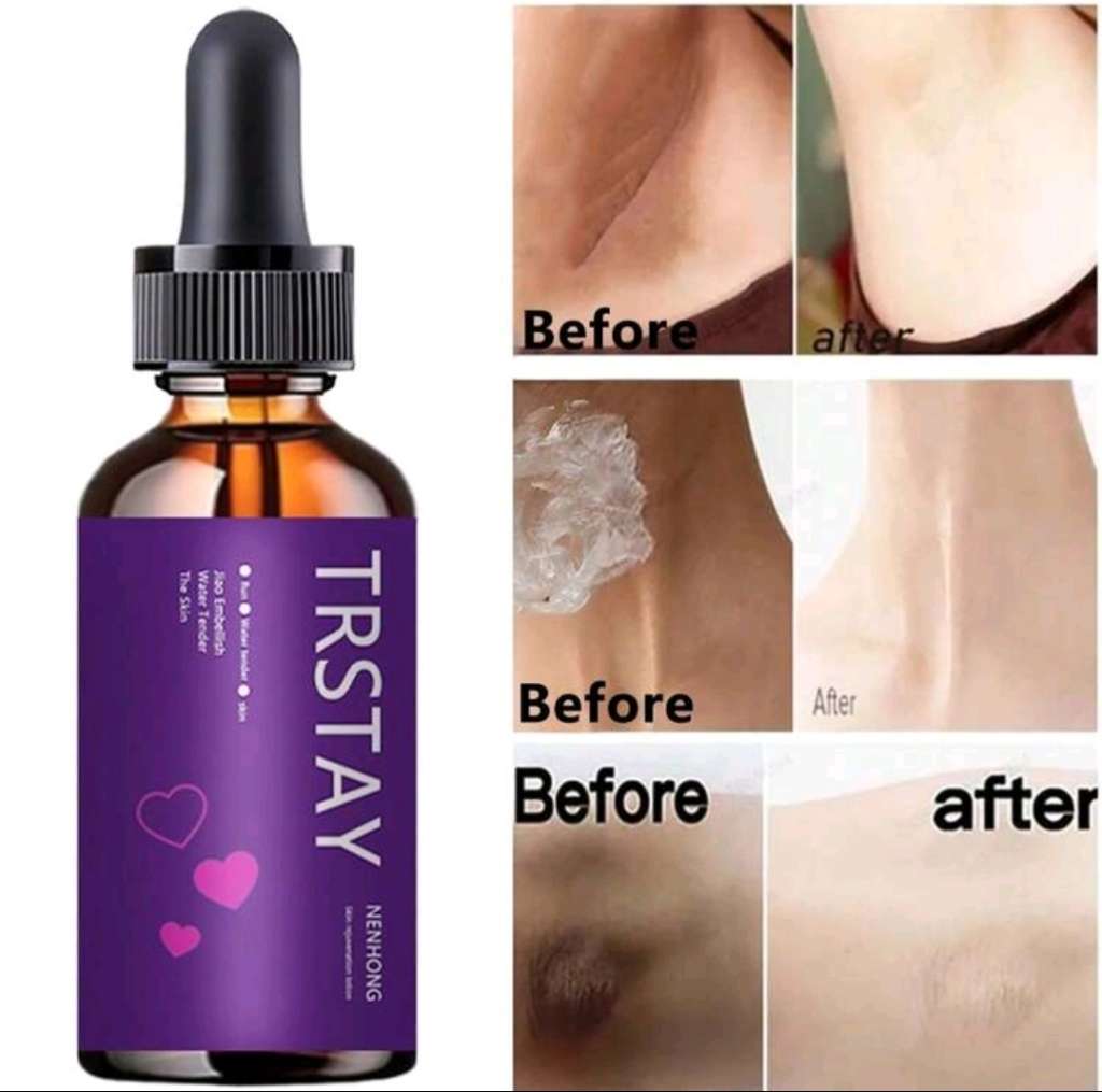 TRSTAY Intensive Wrinkle Repair with Body Serum Lighten