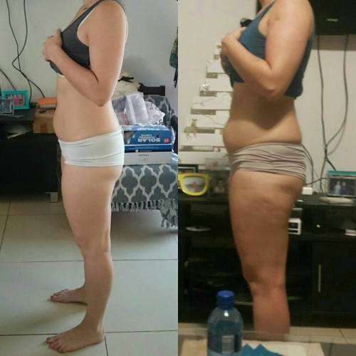 Lipo Fatbusting Injections 12ml