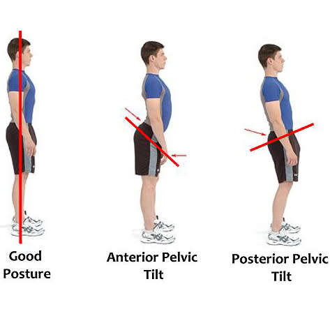 Royal Posture Support