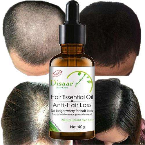 2 x Hair Essential Oil  Anti Hair Loss Oil 30g