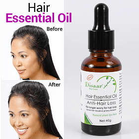 Anti Hair Loss Shampoo & Oil Combo