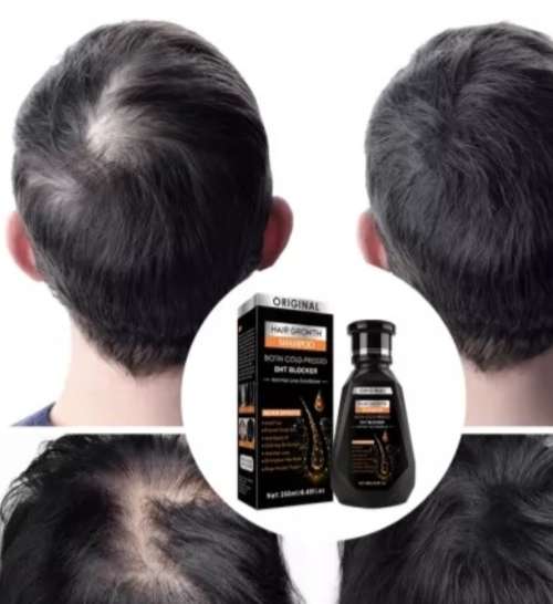Hair Growth Shampoo