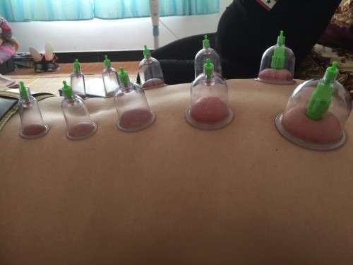 12 Cups Chinese Pull Out Vacuum Cupping Apparatus Therapy Body Massage Pump