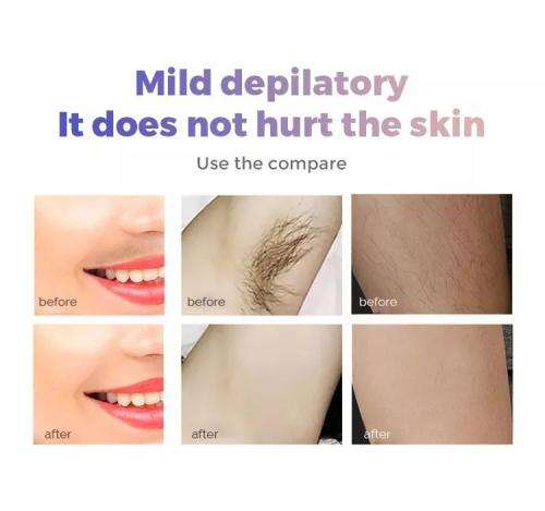 Painless Epilator Magic Depilador