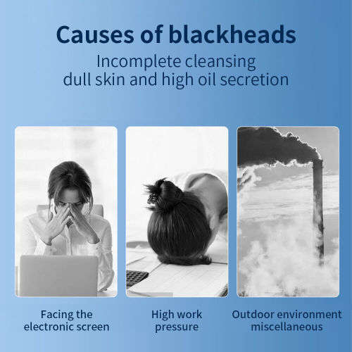 Vacuum Blackhead Remover Facial Skin Pore Acne Pimple 5 Sucker Cleaner Machine