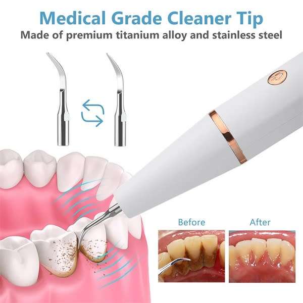 Home Use Rechargeable Electric Teeth Cleaner