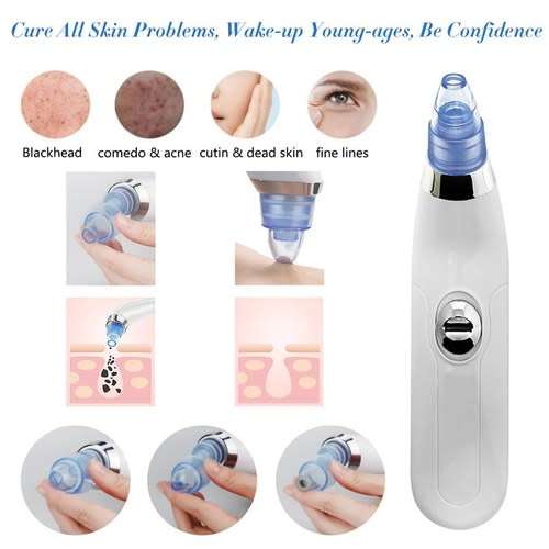 Vacuum Suction Pore cleansing device
