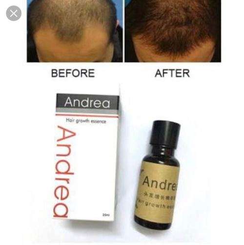 hairloss andrea treatment oil