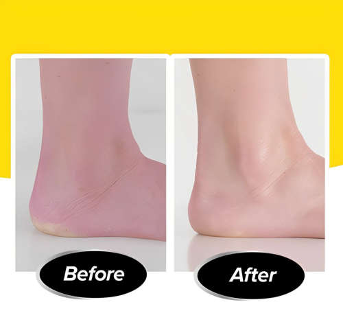 Foot Cleaner Scrubber Removal Kit for Calluses