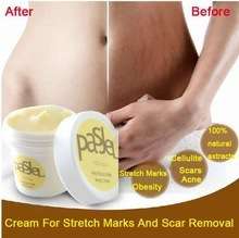 BUY 2 X PASJEL SCAR AND STRETCH MARK CREAM AND GET A CORSET BODYSHAPER WAIST TRAINER WORTH R200 FREE