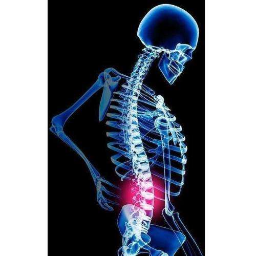 BACK SUPPORT WITH STAYS