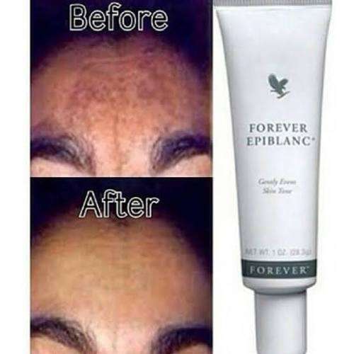 BLEMISHES GONE! FOREVER LIVING PRODUCTS!