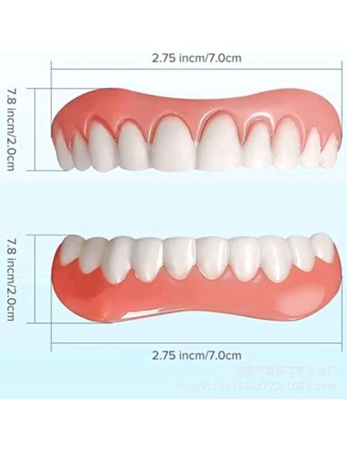 Instant Veneers - Instant Smile