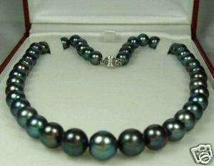 *R1* Genuine Fresh Water Pearl Necklace - Stunning - Brand NEW !!