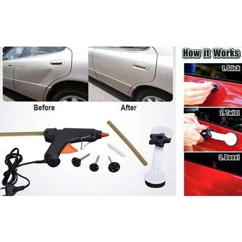 Pops a Dent & Ding Repair Removal Kit