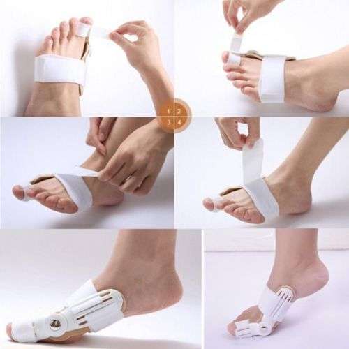 Beauty Trend Adjustable Bunion Corrector-2pcs