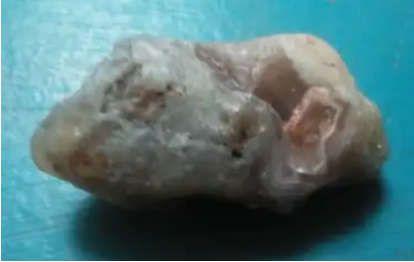 Botswana Agate  dates back nearly 187 million years ago