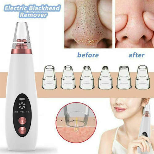 Electric Facial Pore Cleanser Blackhead Acne Remover