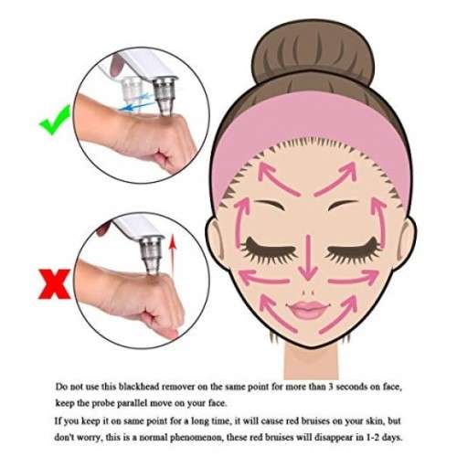 Electric Facial Pore Cleanser Blackhead Acne Remover
