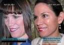 Anti-Ageing Breakthroughs, Nu Skin (lessen wrinkles, acne)