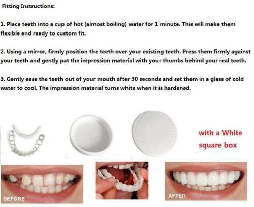 Snap on Smile Teeth veneers