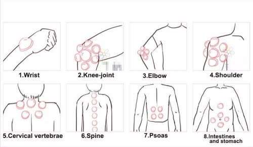 12 Cups Chinese Pull Out Vacuum Cupping Apparatus Therapy Body Massage Pump