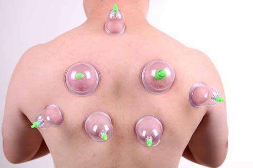 12 Cups Chinese Pull Out Vacuum Cupping Apparatus Therapy Body Massage Pump