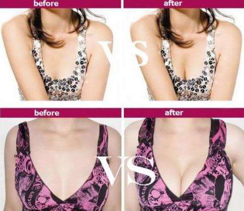 Silicone Nipple Backless Strapless Tube Bra For Bikini Hot Sale