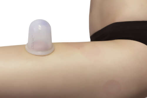 A natural cellulite treatment that works!