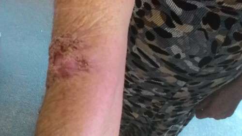 Cancer saved by Xango