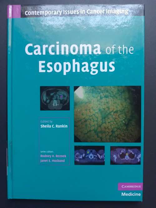 Carcinoma of the Esophagus Edited by Sheila C. Rankin (Cambridge)