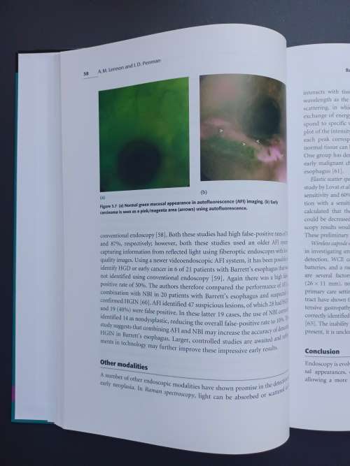 Carcinoma of the Esophagus Edited by Sheila C. Rankin (Cambridge)