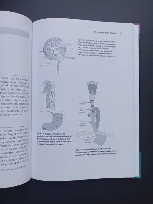 Carcinoma of the Esophagus Edited by Sheila C. Rankin (Cambridge)