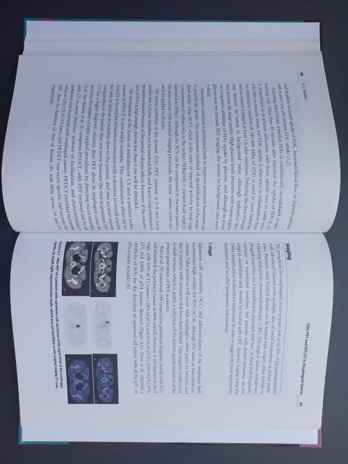 Carcinoma of the Esophagus Edited by Sheila C. Rankin (Cambridge)