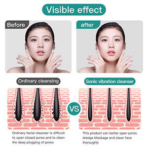 Electric Facial Cleansing Brush Silicone Rotating Face Brush Deep Cleaning Skin