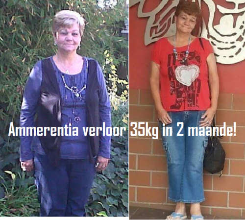 Skinnyme Ultimate Elite Package