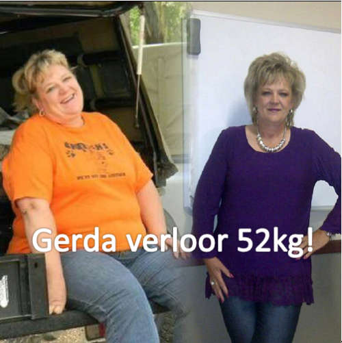 Skinnyme Ultimate Elite Package