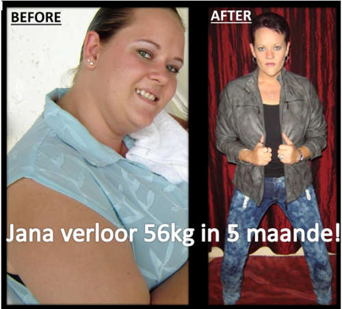 Skinnyme Ultimate Elite Package