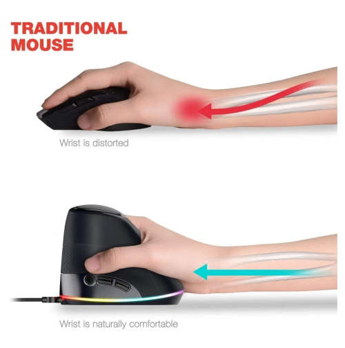 BRAND NEW!!! Vertical Mouse - Eliminate Hand Fatigue When Working On Your Computer! - WB-888